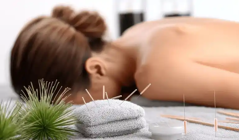 Процедура иглоукалывания