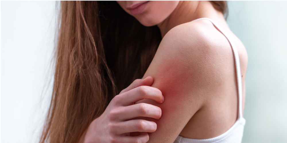 young-woman-suffering-from-itching-on-her-skin-and-scratching-an-itchy-place 1.png